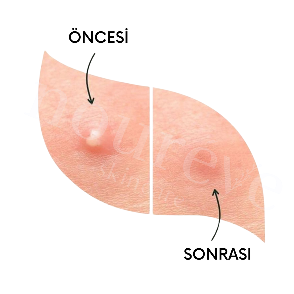 Phytoactive_Exfoliant_Solution_Deep_Pore_Cleanser_Duo_Akne_Siyah_Nokta_Komedon_Kar_t_G_zenek_S_k_la_t_r_c_Bak_m_Rutini6