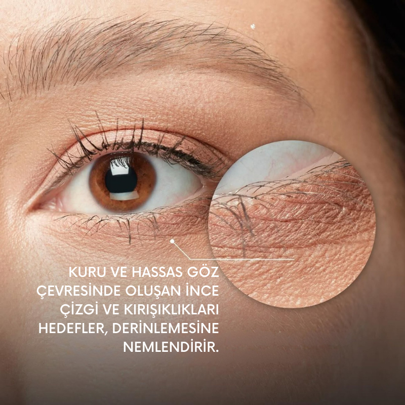 noureve_goz_cevresi_kirisiklik_ve_ince_cizgi_bakimi