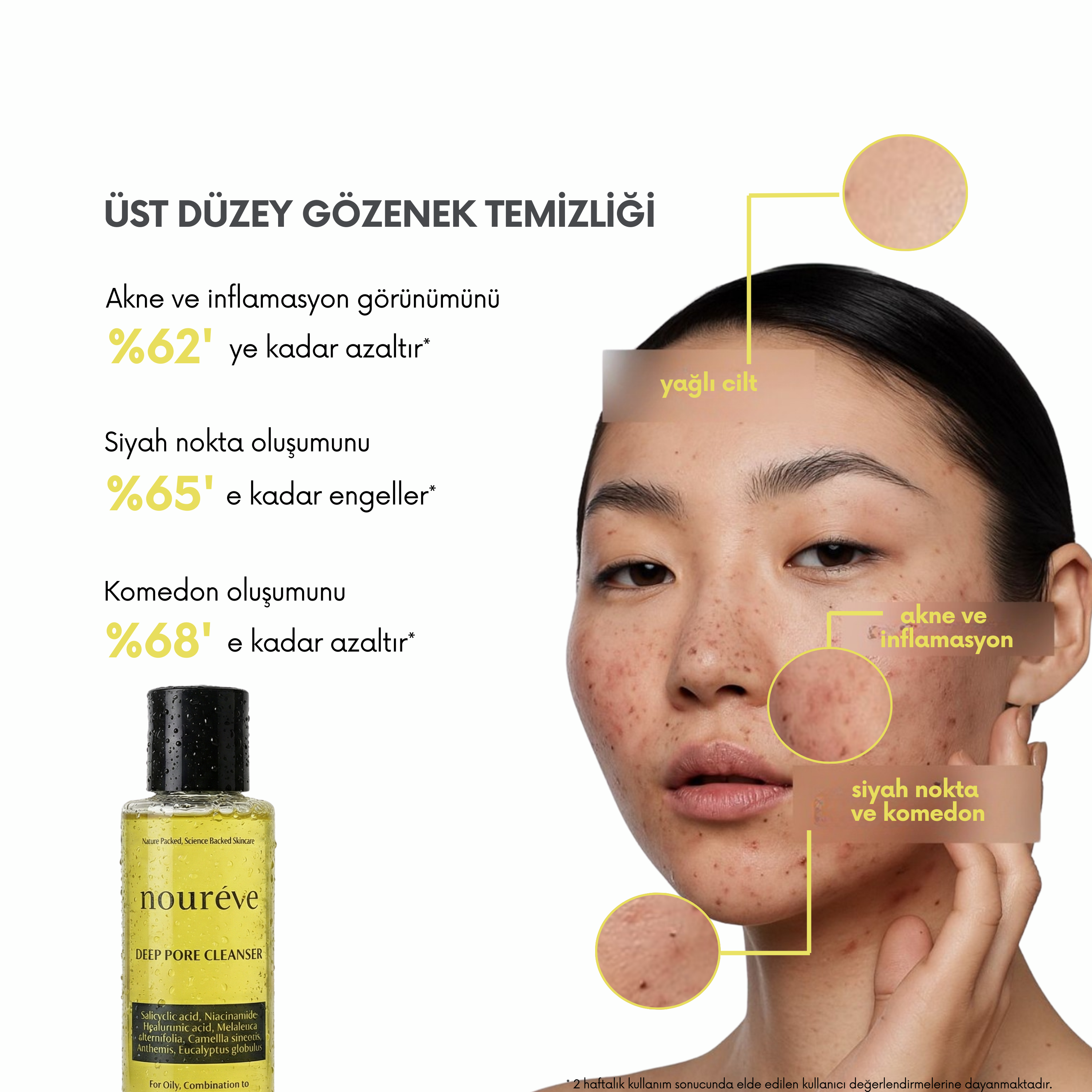 noureve_ust_duzey_gozenek_temizligi
